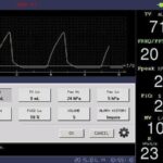 Ventilator AM- PA-700B (Standard model)