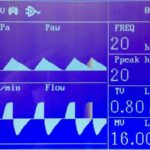 AM-01B Multifunctional Anesthesia Machine (Advance model)